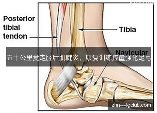 五十公里竞走胫后肌腱炎,康复训练控量强化足弓 五十公里竞走胫后肌腱炎,康复训练控量强化足弓